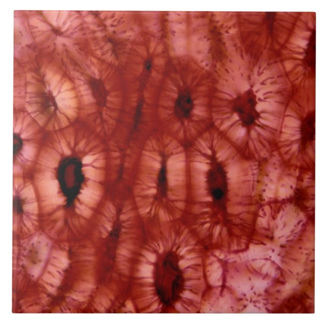 Carreau En Céramique Cellules de Sclerenchyma d'un puits de cerise (Devant)