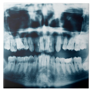 Carreau Rayon X des dents