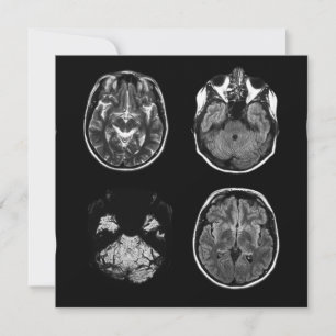 Carte Analyse IRM du cerveau