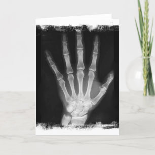 Carte B&W X-ray Skeleton Main