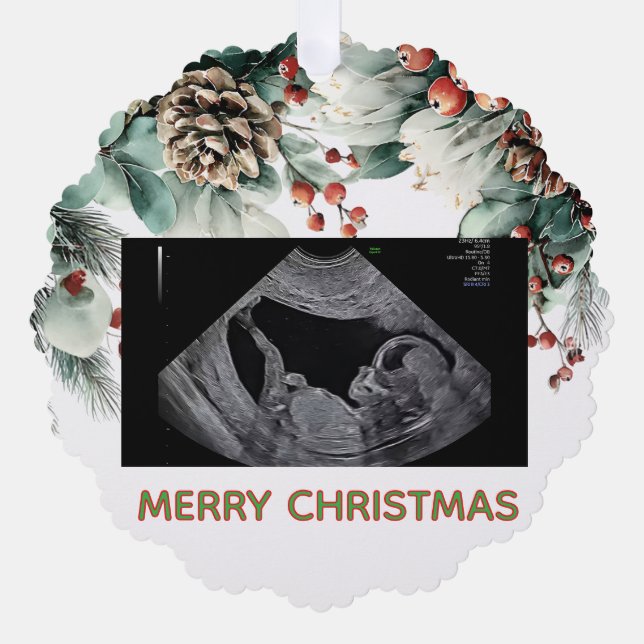 Carte Décorative Custom First Christmas Expecting Photo Ornament (Recto)