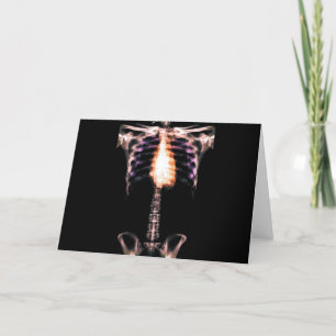 CARTE LE TORSE SQUELETTIQUE DE RAYON X NERVURE