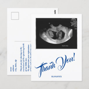 Carte Postale Baby shower Ultrasound Boy Merci bleu.