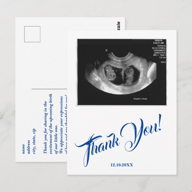 Carte Postale Baby shower Ultrasound Boy Merci bleu. (Devant / Derrière)