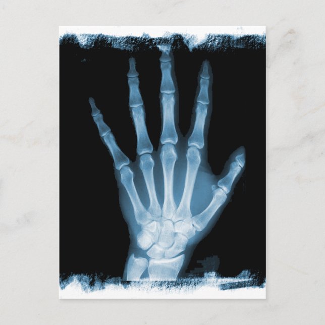 Carte Postale Bleu X-ray Squelette main (Devant)