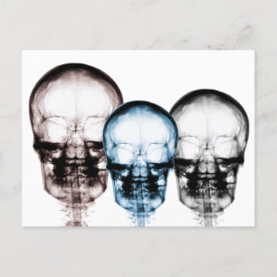 Carte Postale Couleurs mixtes X-Ray Vision Skeleton Skulls