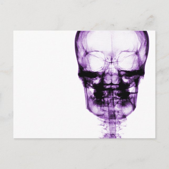 Carte Postale Crâne de vision à rayons X - pourpre (Devant)