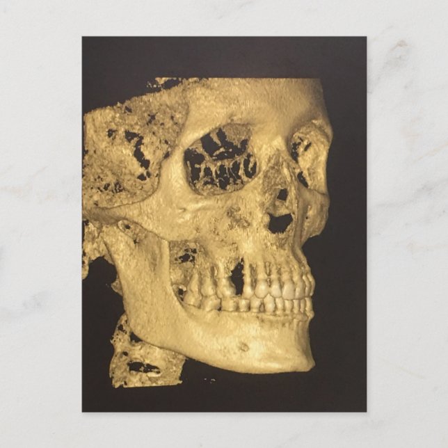 Carte Postale Crâne effrayant (Devant)
