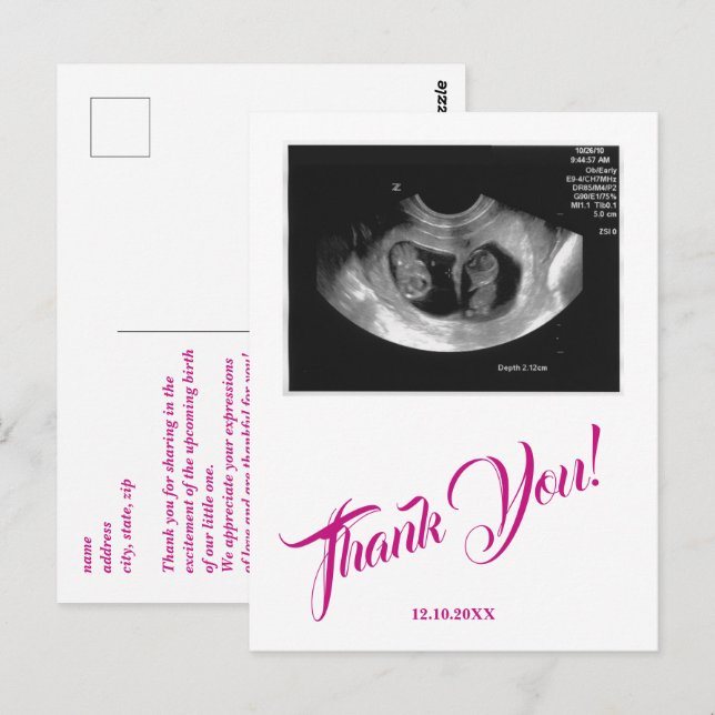 Carte Postale Échographie pour Baby Shower Fille Rose Merci. (Devant / Derrière)