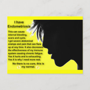 Carte Postale Endovie