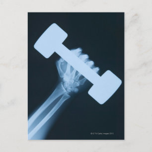 Carte Postale Image par rayons X de la main humaine avec poids, 