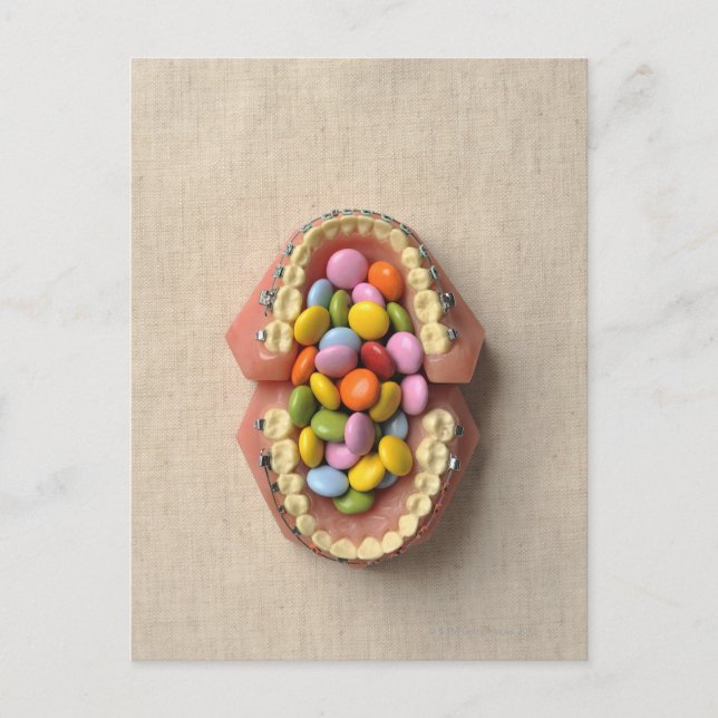 Carte Postale Le chocolat servi dans le modèle dentaire (Devant)