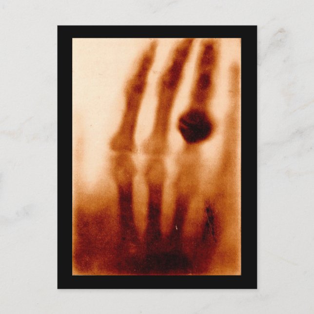 Carte Postale Le premier X-Ray, 1901, photo (Devant)