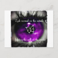 lupus eye22.jpg
