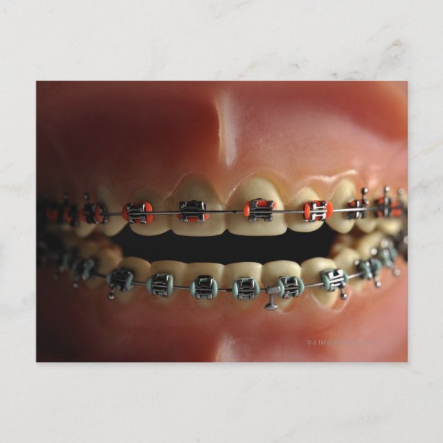 Carte Postale Modèle dentaire et bracelets de dents (Devant)