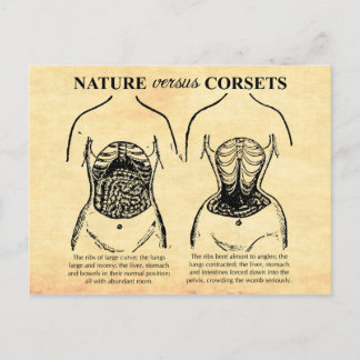 Carte Postale Nature contre Corsets