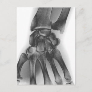 Carte Postale Normal wrist, X-ray
