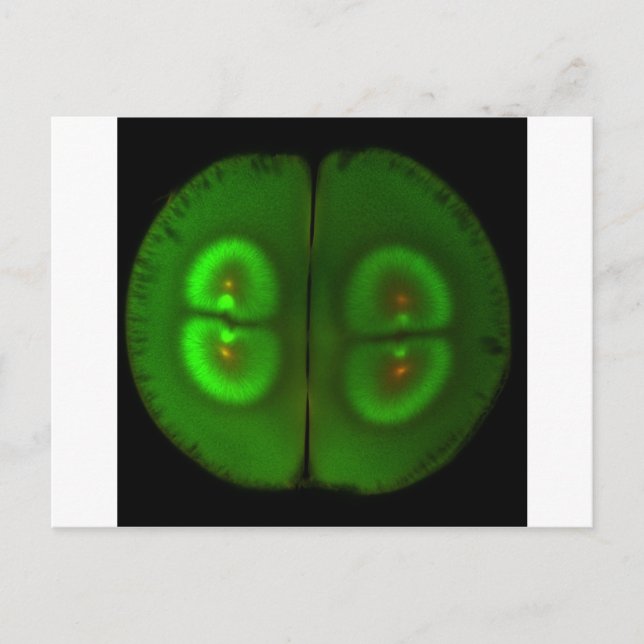 Carte Postale OEuf de grenouille fertilisé (Devant)