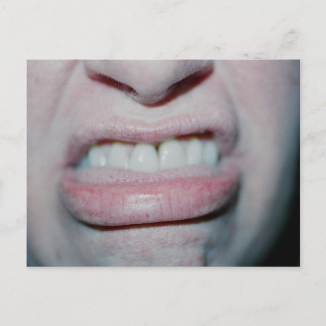 Carte Postale Pas de sourire aujourd'hui (Devant)