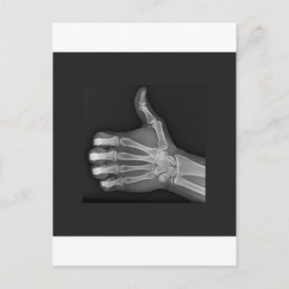 Carte Postale Pouce vers le haut