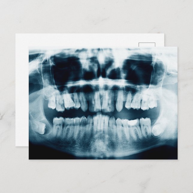 Carte Postale Rayon X des dents (Devant / Derrière)