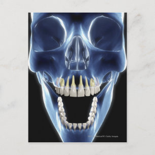 Carte Postale Regarder les dents humaines par rayons X
