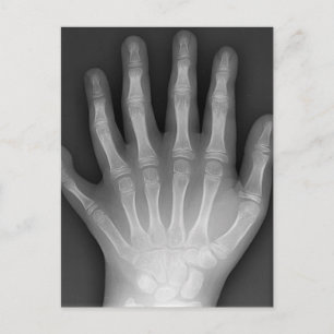 Carte Postale Six mains digitées, rareté Médicale, rayon X