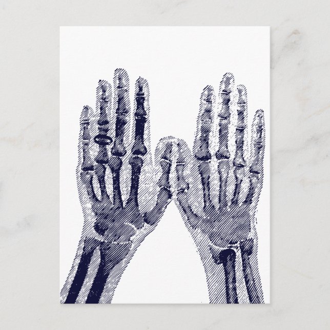 Carte Postale Skeleton Hands Xray Image dessin Anatomie humaine (Devant)