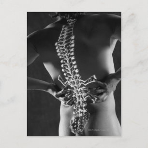 Carte Postale Vue de l'accord de colonne vertébrale