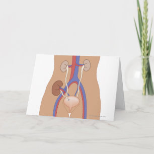 Carte Transplantation rénale