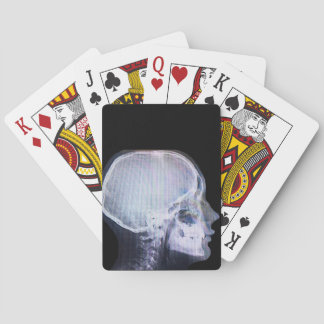 Cartes de jeu de rayon X