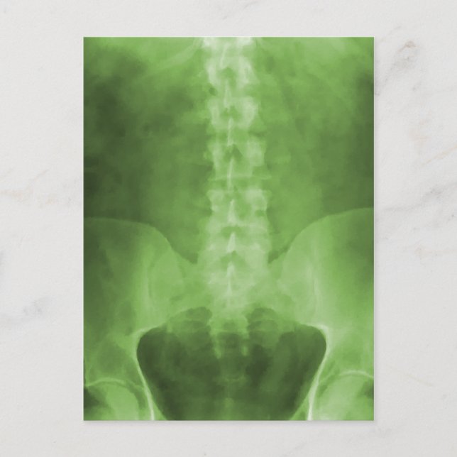 Cartes postales Digital X-Ray Art Vert (Devant)