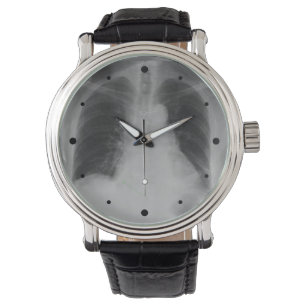 Chest X Ray ~ watch Armbanduhr