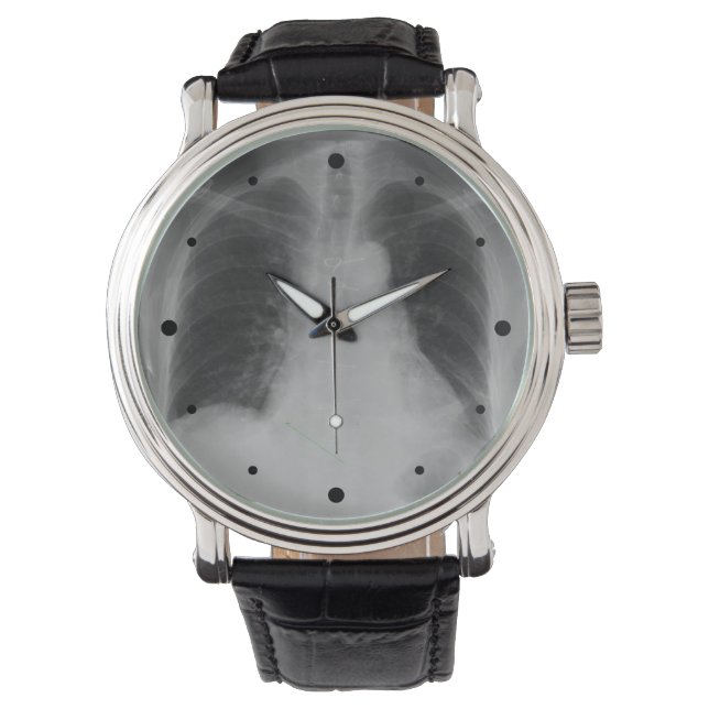Chest X Ray ~ watch Armbanduhr (Vorderseite)