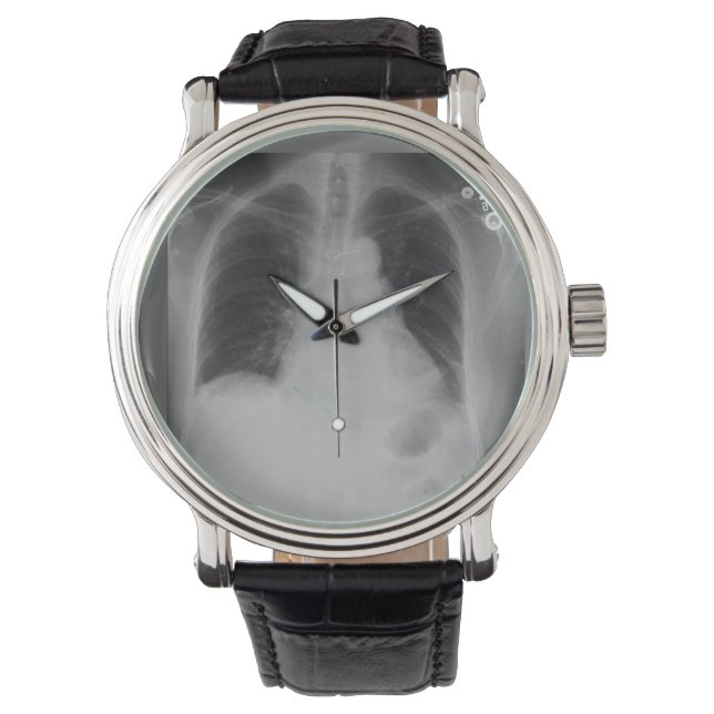Chest X Ray ~ watch Armbanduhr (Vorderseite)