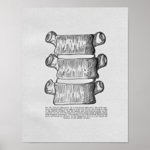 Chiropraktikvertebraler Subluxations-Vintager Poster