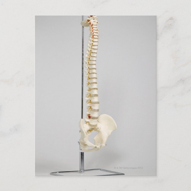 Chiropraktisches Skelett Postkarte (Vorderseite)