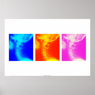 Chiropratique à rayons X cervicaux affiche 2