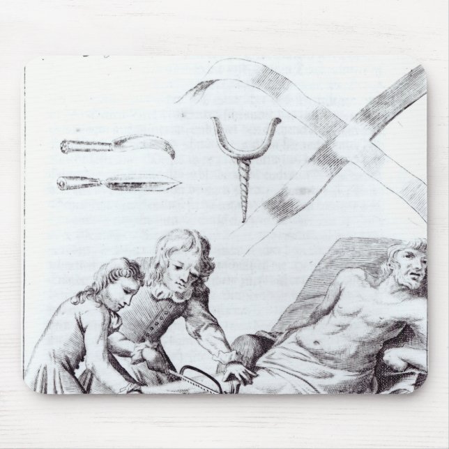 Chirurgische Operation, zum eines Beines zu Mousepad (Vorne)