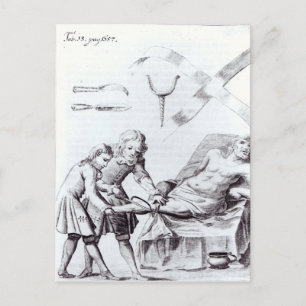 Chirurgische Operation zur Amputation eines Beins Postkarte