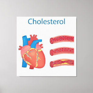 Cholesterin Leinwanddruck