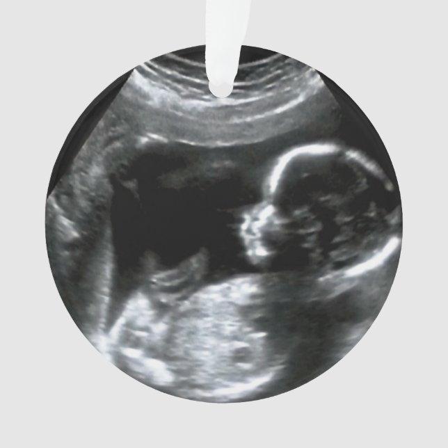 Christmas Baby Sonogram Picture Gift Ornament (Vorderseite)