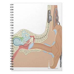 Cochlear Implantate Notizblock