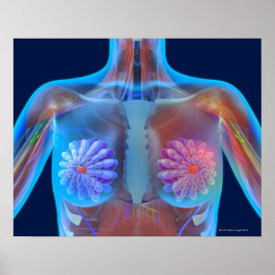 Computer artwork representing breast cancer, poster