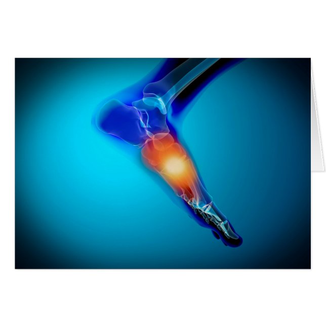 Conceptual Image of Pain in Human Foot (Vorderseite (Horizontal))