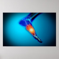 Conceptual Image of Pain in Human Foot