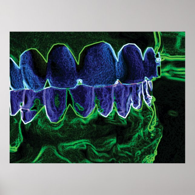 Cool Dents Modèle Dentiste Orthodontiste Poster (Devant)
