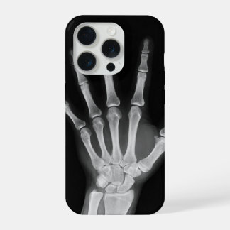 Housse Skeleton pour iPhone 15 pro