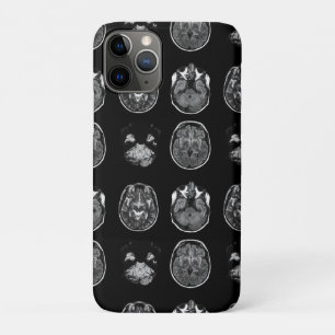 Case-Mate iPhone Case Analyse IRM du cerveau