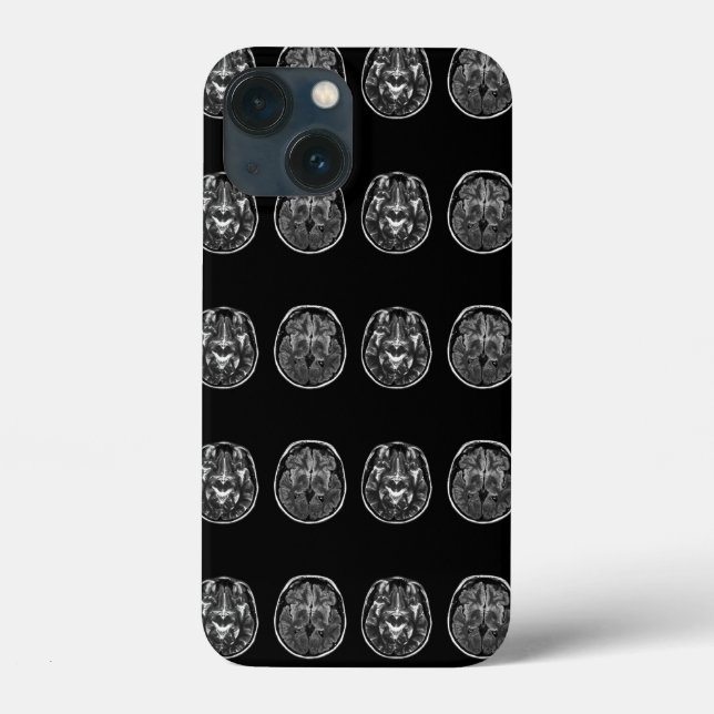 Coques Case-Mate iPhone Analyse Mri du cerveau (Verso)